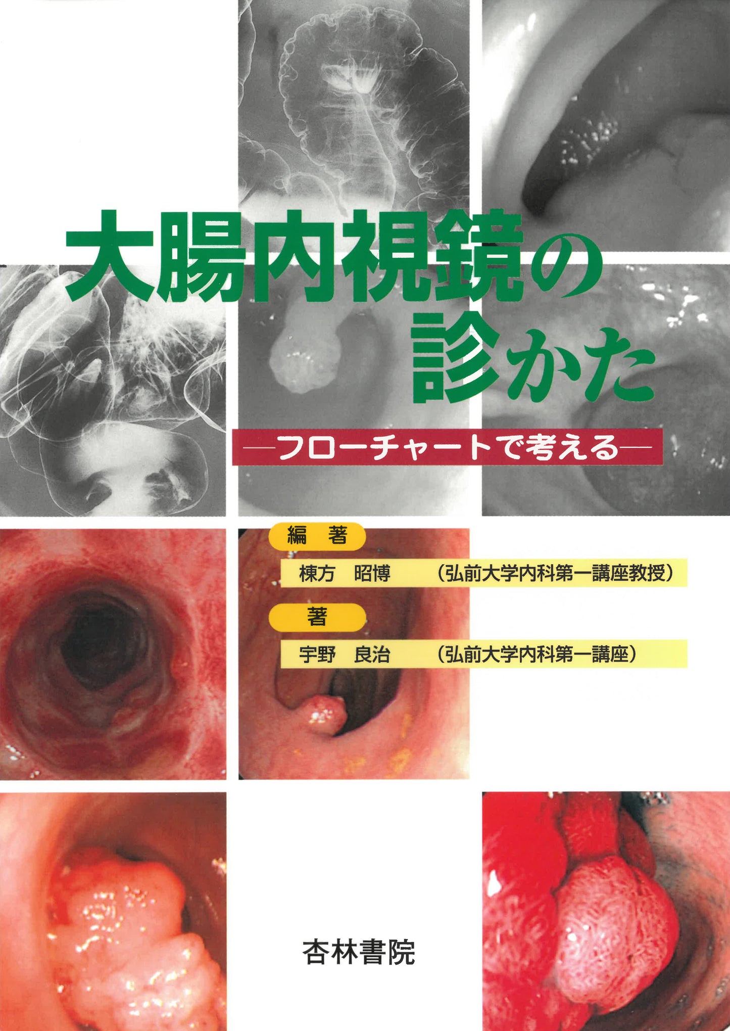 大腸内視鏡の診かた