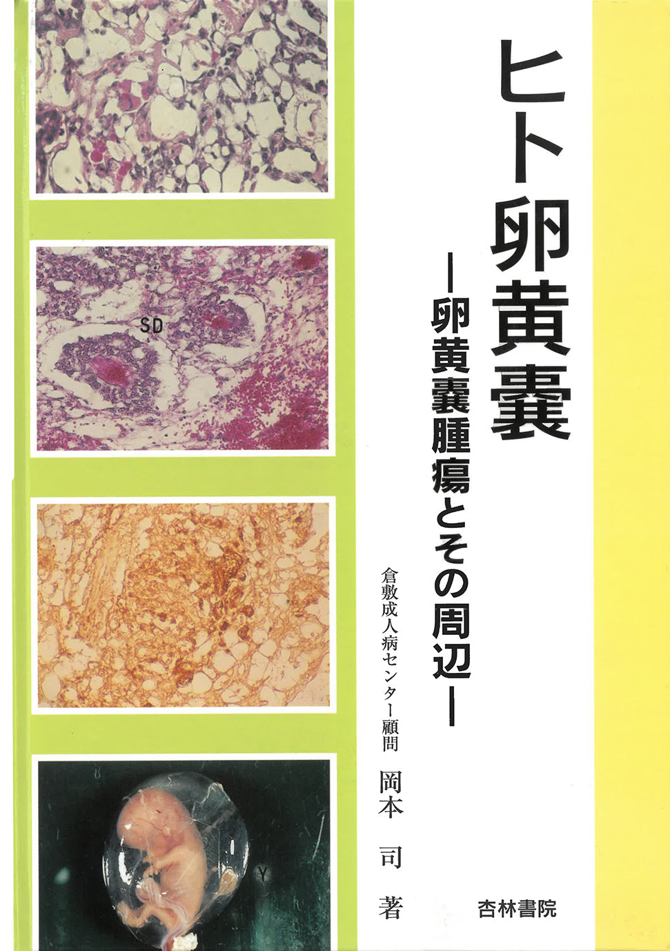 ヒト卵黄嚢